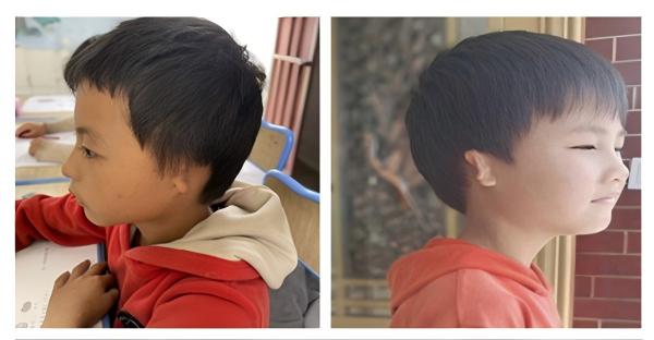 心系山区 ,  护佑山童 ——记傈僳族娃娃千里医疗救助