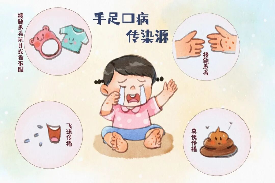 手足口病传染源.jpg 手足口病传染源.jpg